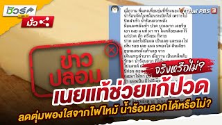 เนยแท้ช่วยแก้ปวด ลดตุ่มพองใสจากไฟไหม้ น้ำร้อนลวกได้หรือไม่? | ชัวร์หรือมั่ว