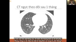 Di chứng tại phổi sau COVID-19