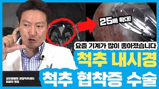 척추를 수술했는데 순식간에 회복이 된다고? 척추관협착증 (성남 성모윌병원)