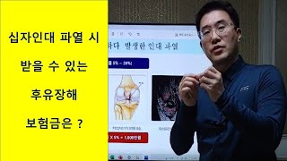 십자인대 파열과 후유장해 보험금