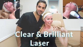 The Clear \u0026 Brilliant Laser with Dr. Bashey - Better Skin Over 50