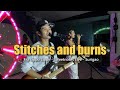 Stitches and Burns - Fra Lippo Lippe | Sweetnotes Live