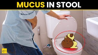 Mucus in Stool | Causes, Symptoms, and Treatment - Credihealth