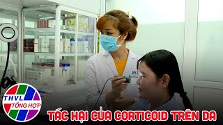 Sức khỏe của bạn: Tác hại của corticoid trên da