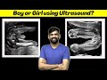 😳How to Determine Boy or Girl Using Ultrasound? | NEET | Anmol Sharma