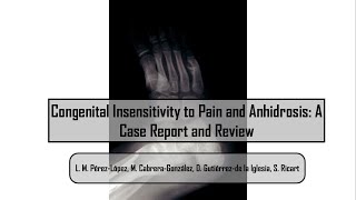 Congenital Insensitivity to Pain and Anhidrosis: A Case Report and Review