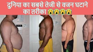 Bariatric Surgery | Weight Loss Surgery In Jalandhar | No1 Hospital In India