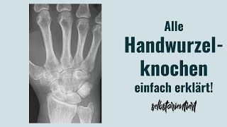 Welche Handwurzelknochen gibt es? - Os pisiforme | Os trapezium | Os lunatum | Os hamatum capitatum