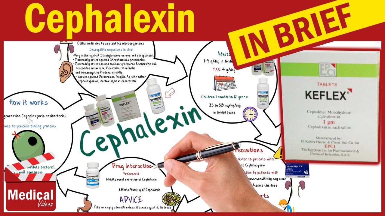 Cephalexin ( Keflex ): What Is Cephalexin Used For, Dosage, Side ...