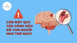 Cơn đột quỵ não tấn công bạn như thế nào?| BS Nguyễn Thị Minh Phương, Bệnh viện ĐKQT Vinmec