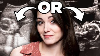Guess The Person From Their Ultrasound (game)