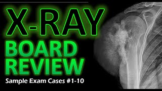 X-Ray Board Review - Sample Exam Cases #RadiologyBoardReview #RadiologyEducation #XRayInterpretation