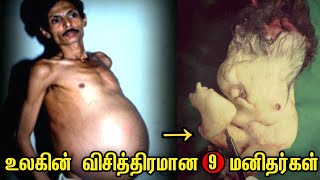 உலகில் விசித்திரமாக பிரபலமான 9 மனிதர்கள்.