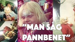 STORYTIME | När jag slog hål i pannan