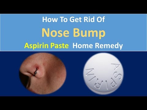 How to Get Rid Of Nose Bump | Aspirin Paste Home Remedy How to Get Rid Of Nose Bump | Aspirin Paste Home Remedy
