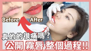 【霧唇】完全改觀！會痛？孖潤腸？為什麼要做？能改善唇色？💋👌🏻 EP1