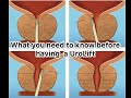 What you need to know before a UroLift procedure for the treatment of benign prostatic enlargement