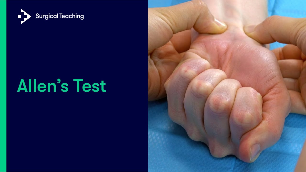 Allen Test Anatomy