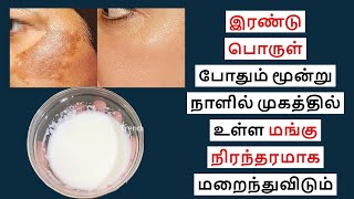 மங்கு மறைய இதை செய்தால் போதும் மூன்று நாளில் மறைந்துவிடும் | dark pigmentation home remedy