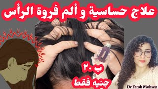 علاج ألم و التهاب فروة الرأس و إيقاف التساقط الناتج عنه و بديله الطبيعي |فرح محسنDrjoy