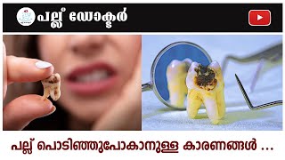 പല്ല് പൊടിഞ്ഞുപോകാനുള്ള കാരണങ്ങൾ ...