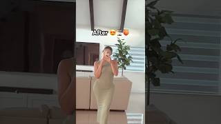 The BBL curves 😍 #bbl #surgeryrecovery #surgery #beforeandafter #curves #shorts #viral