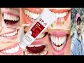 Sp-5 Toothpaste | Honest Review