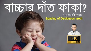 বাচ্চার দাঁত ফাকা? ভাল না খারাপ? Natural spacing of baby Teeth | Good or Bad  | Crowding or Spacing?