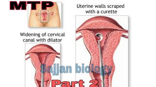 Reproductive health- MTP/Part-2