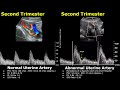 uterine artery spectral doppler ultrasound normal vs abnormal images pregnant nongravid uterus usg