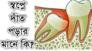 জানেন কি স্বপ্নে দাঁত পড়ে যাওয়ার আসল অর্থ !