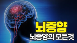 머리가 아프면 이 병을 의심해라! 조기치료가 중요하다! l 뇌종양 l 건강플러스 l 20220622