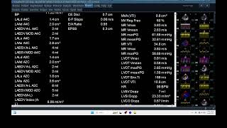 IQ 345 HEMODYNAMIC ECHOPAC ANALYSIS ECHOCARDIOGRAPHY REPORT