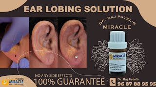 How To Repair Ear Lobe / Non Surgically Ear lobe / Ear Lobe Treatment / Ear Sticking Glue/ Painless