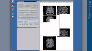 Test: SPM8 tutorial (MoAE)