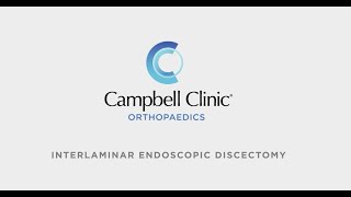 Interlaminar Endoscopic Discectomy at Campbell Clinic Orthopaedics