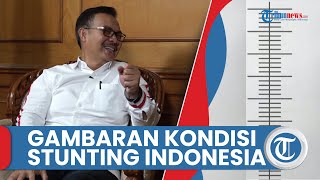 Kepala BKKBN Beri Gambaran Kondisi Stunting di Indonesia: Bali, Yogyakarta, DKI Cenderung Rendah