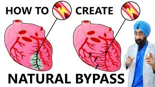 Only way to create Natural Bypass, even Before HEART BLOCKAGE | Dr.Education Hindi