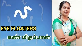 EYE FLOATERS கண் மிதப்பான் //Dr. Sangeetha