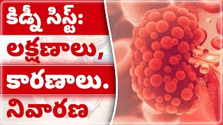 Kidney Cysts: Symptoms, Causes \u0026 Treatment | కిడ్నీ తిత్తులు | Dr Puru Dhawan | Sriaas