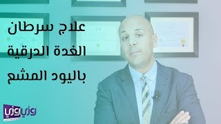 علاج سرطان الغدة الدرقية باليود المشع