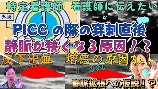 ＃捌の巻　特定看護師・看護師さんに伝えたい！　採血　サーフロ留置　エコーガイド下で静脈穿刺の「やり直し」をした場合、静脈径が狭くなり、静脈の循環障害、皮下出血の増大に繋がるという仮説のお話！！！