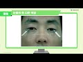 중등 및 기타ㅣ 고등 health 인 人 원격 보건교육 7. 일상생활의 건강관리 눈관리