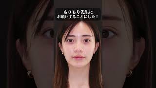 美人の9割やってること。自然で綺麗な小顔整形はもりもり先生にお任せ下さい👨‍⚕️ #美容整形