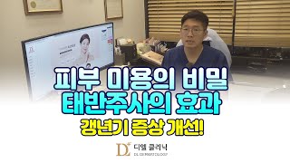 피부 미용의 비밀, 태반주사의 효과와 갱년기 증상 개선!