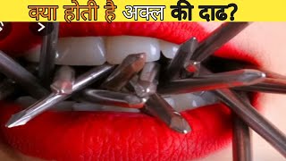 ये क्या होती है अक्ल की दाढ़?what is wisdom tooth|