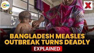 BANGLADESH MEASLES OUTBREAK KILLS AT LEAST 98 CHILDREN | VACCINE GAPS EXPOSE RISKS | NewsX World