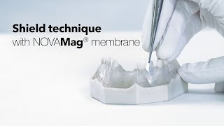 Shield technique with NOVAMag® membrane