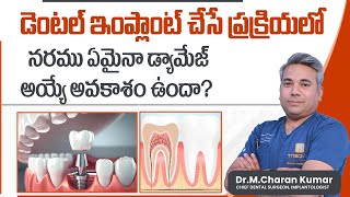 Nerve Damage During the Dental Implant Procedure in Telugu | Dental Nerve Damage Treatment | Eledent