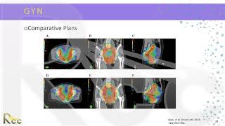 IMRT 2.0 | Session 14 | High yield clinical applications of IMRT Part 1